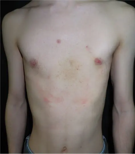 After — case 01