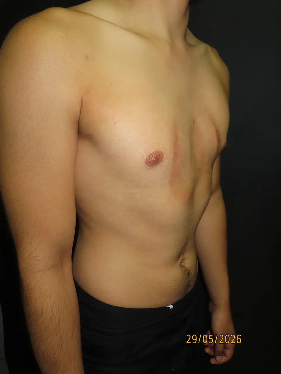 After — case 01 view 2