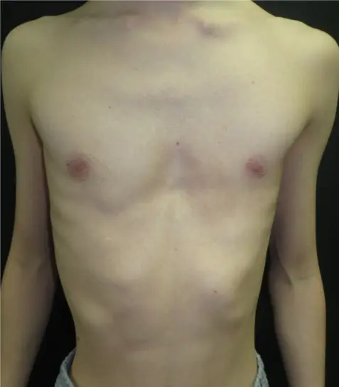 Before — case 01