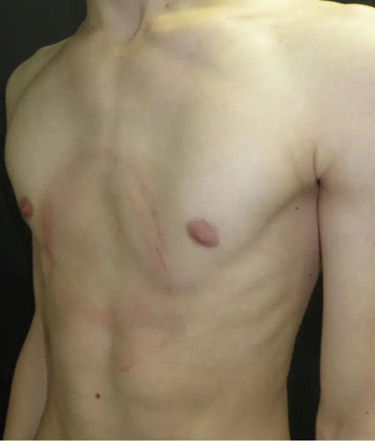 After — case 03