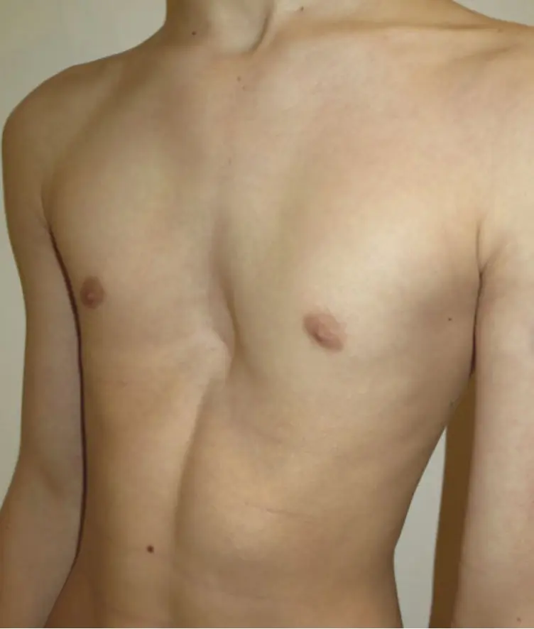 Before — case 03