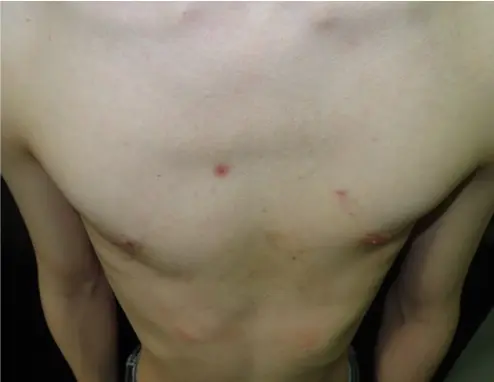 After — case 04