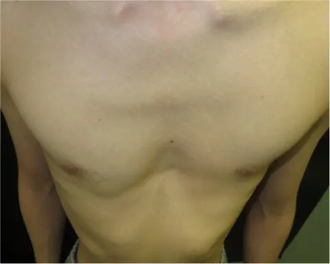 Before — case 04