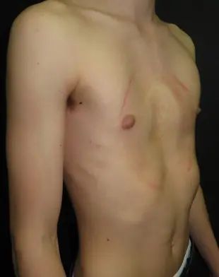 After — case 06