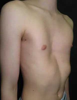 Before — case 06