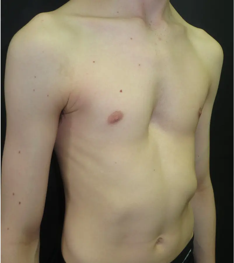 Before — case 07