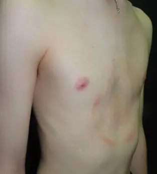 After — case 08
