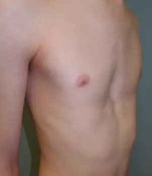 Before — case 08