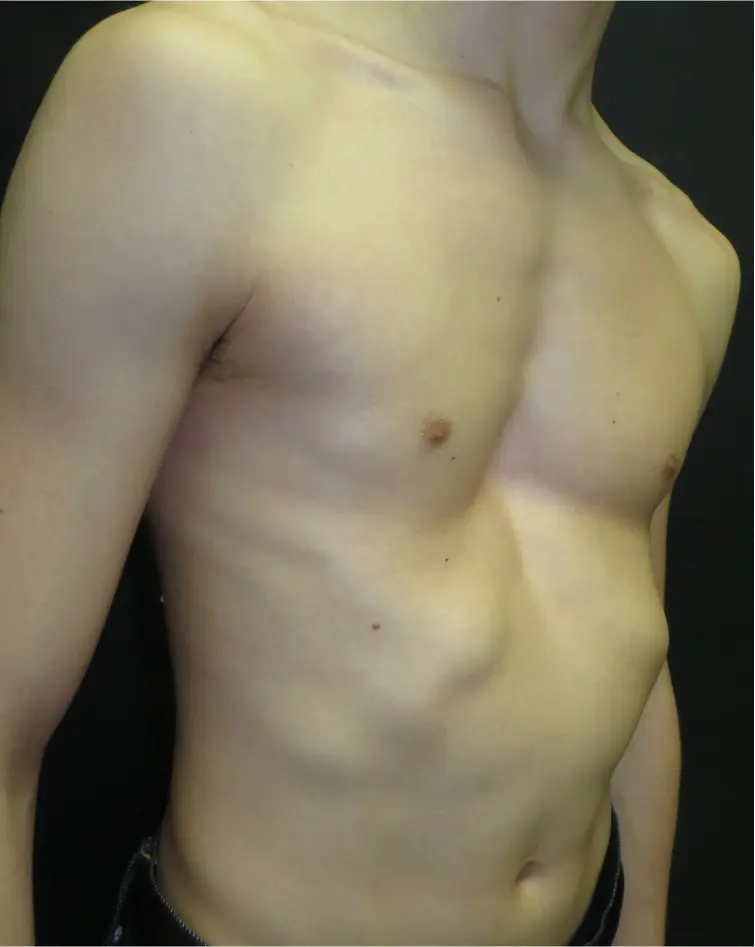 Before — case 09