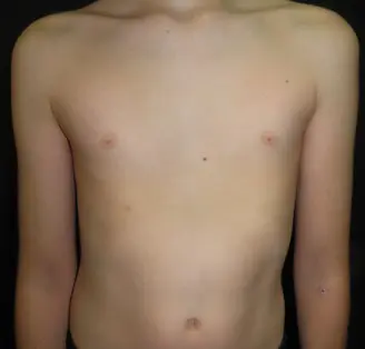 After — case 11