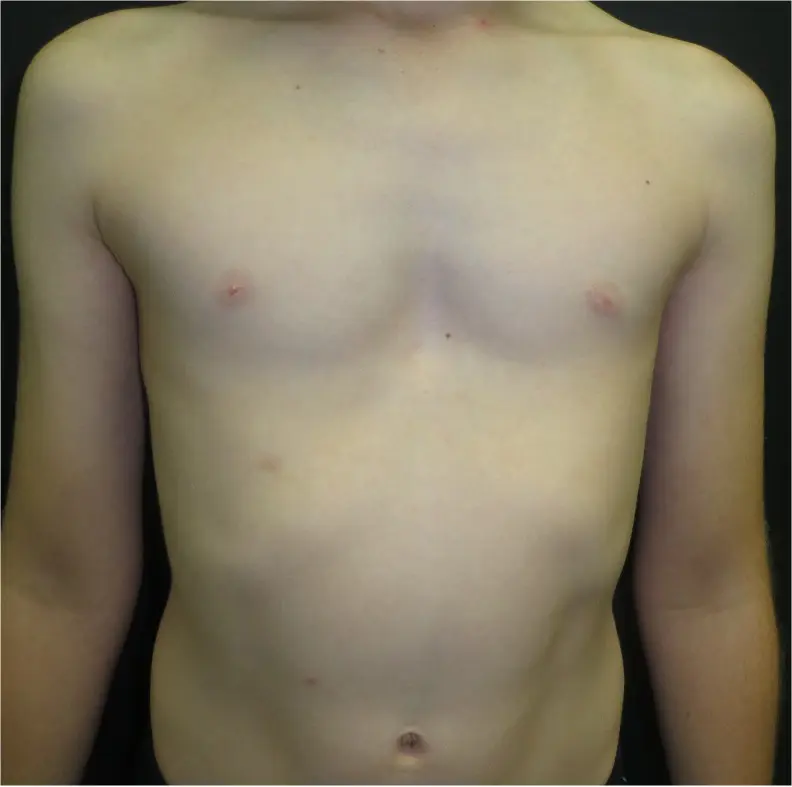 Before — case 11