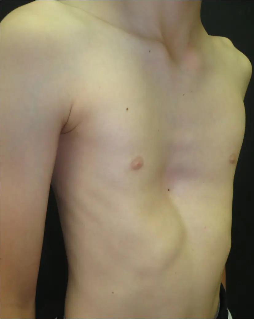 Before — case 12