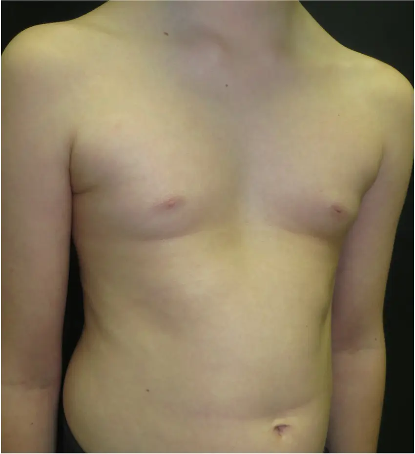 Before — case 14